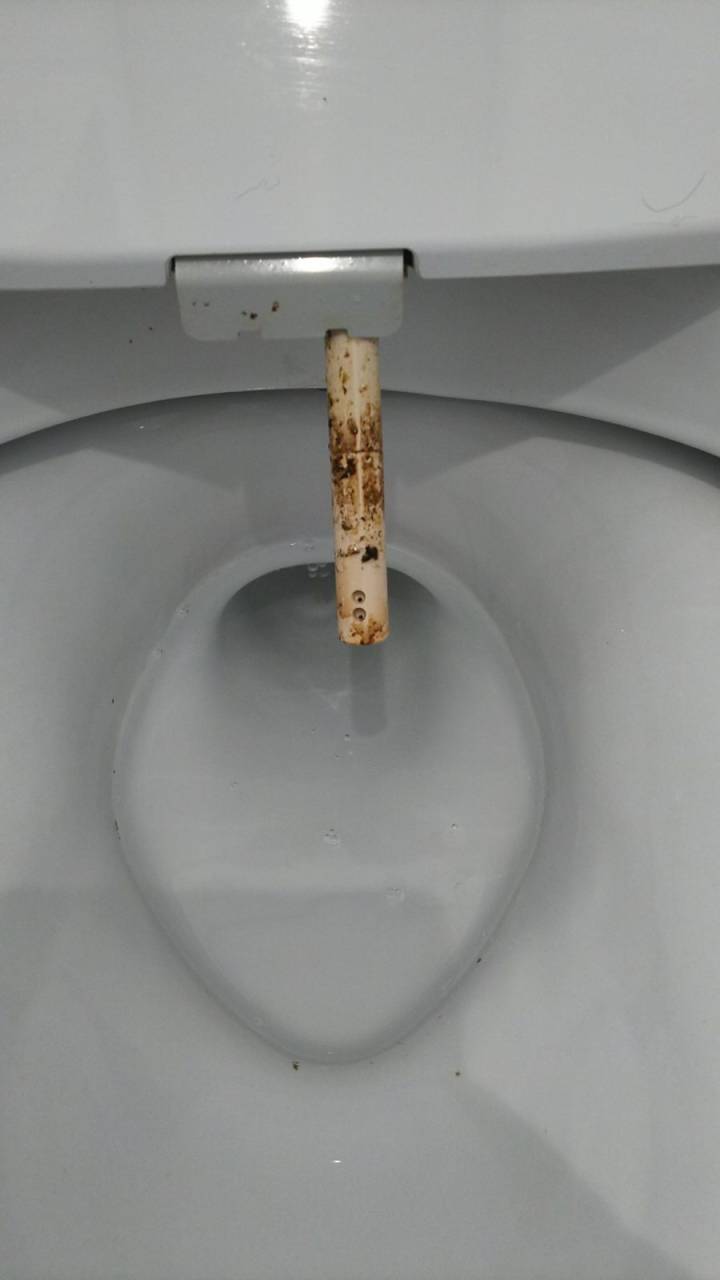 ノズル(清掃前)<br>ノズルの汚れ